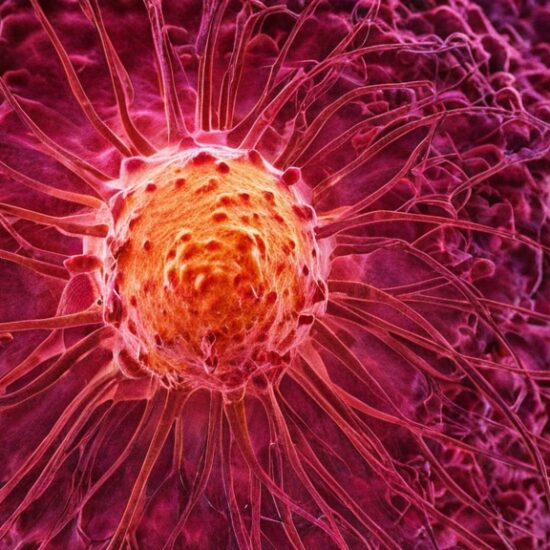 Photo Cancer Recurrence